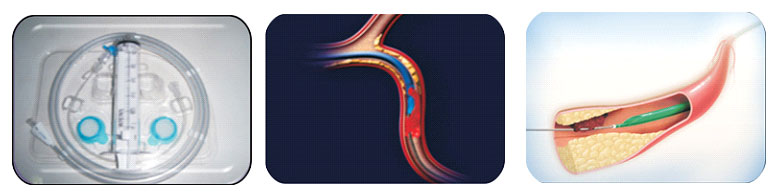 Xpirator Thrombus Aspiration Catheter consists of: - Xpirator – Thrombus Aspiration Catheter - Nano Therapeutics Pvt. Ltd. - Heart Stent Manufacturing Company Surat, India